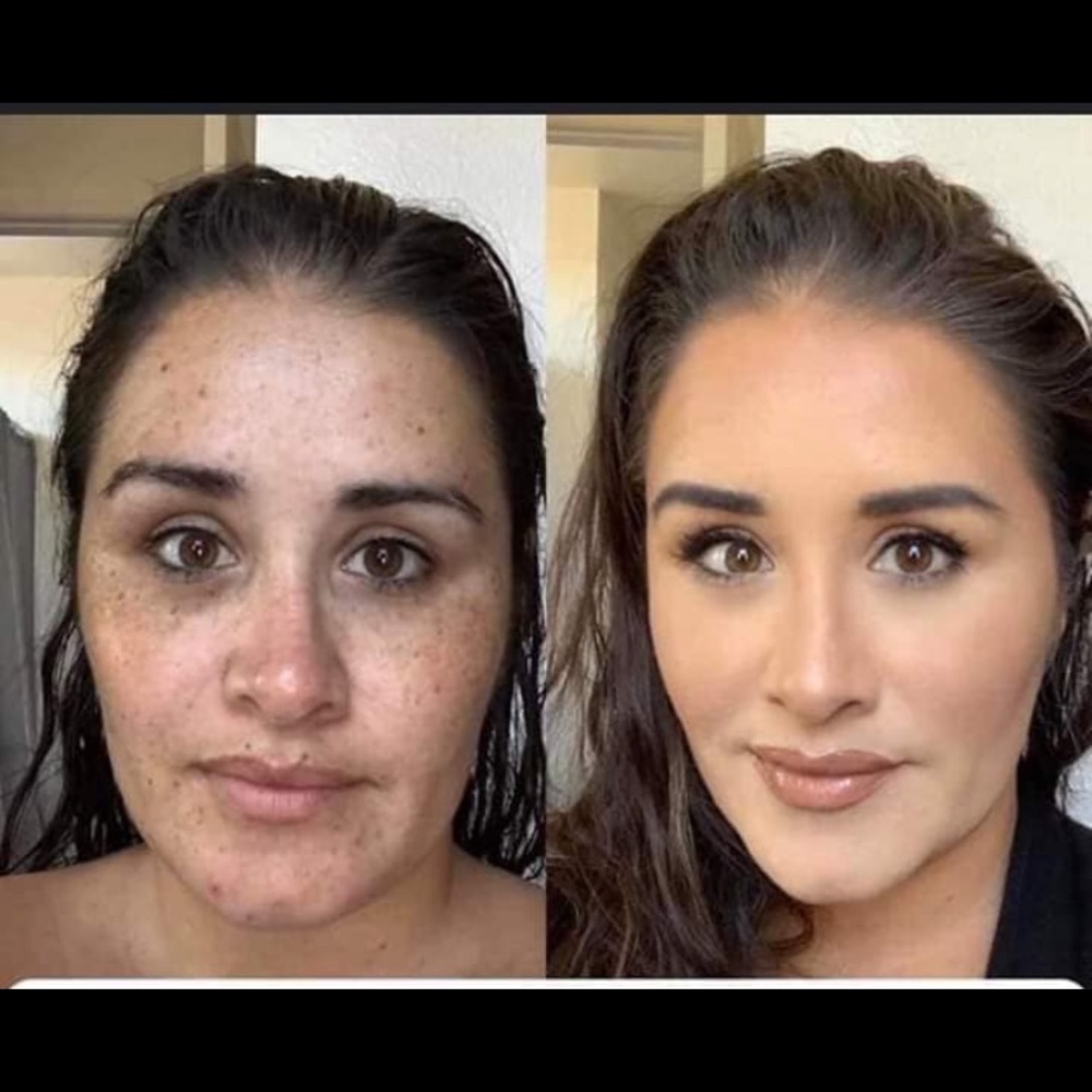 Flawless face bundle!